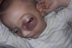 Diagnosticat cu cancer – o formă rară – la doar un an şi 10 luni. Are nevoie de ajutor!