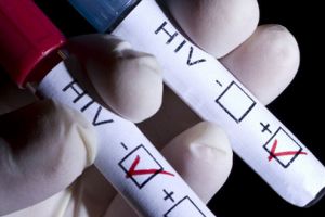 Aproximativ 250 de hunedoreni infectaţi cu HIV