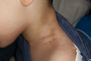 O educatoare din Focşani a fost reclamată la Parchet pentru că ar fi strâns de gât un copil