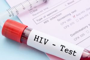 700 de oameni, diagnosticaţi cu HIV în fiecare an în România
