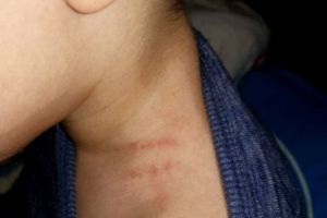 Educatoarea din Focşani, acuzată că a strâns un copil de gât şi de ORGANELE GENITALE, merge în continuare la grădiniţă. Femeia e în atenţia agenţilor de la Investigaţii Criminale