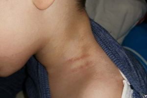 Educatoarea din Focşani, acuzată că a agresat un copil de 3 ani, cercetată de poliţie