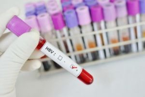 Planul Ministerului Sănătăţii privind controlul hepatitelor virale în România pentru perioada 2018-2030