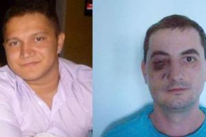 Gest impresionant al unui medic. L-a iertat pe cel ce l-a mutilat în schimbul unor fapte bune