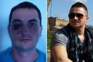 Condamnat la fapte bune de CRACIUN. Un medic din Iasi,iarta agresorul care l-a batut crunt