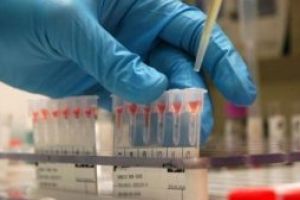 Pintea: Vom propune o HG privind numarul si tipurile de analize care trebuie efectuate personalului din spital