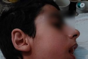 Denis are nevoie de 300 de euro pentru sonda prin care este hrănit