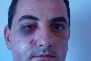 Îşi aminteşte fiecare pacient care i-a murit pe masa de operaţie. Povestea medicului care şi-a iertat călăul şi a refuzat banii Occidentului 