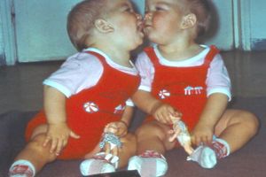 Povestea unui succes. Gabriel Ionescu, doctorul român care a separat în 1983 două siameze din Botoşani