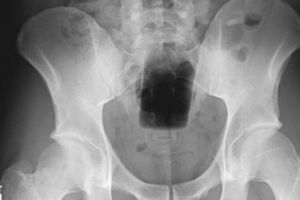 PERVERŞII PLANETEI au uimit lumea cu apucăturile lor bolnave. Ce le-a putut trece prin minge, INCREDIBIL. Foto în articol