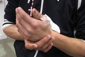 DÂMBOVIȚA: Un copil de 13 ani, rănit de un articol pirotehnic