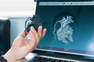 Tehnologia 3D printing în cardiologie