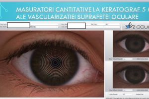 Aparatură de ultimă generaţie în Clinica de Oftalmogie din cadrul Spitalului Universitar de Urgenţă Bucureşti