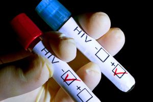 Indemnizaţii de hrană în valoare de peste 23.000 de lei pentru 47 de gorjeni cu HIV