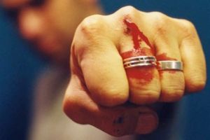 S-au bătut cu topoare la un restaurant din Vâlcea! Șapte petrecăreţi au ajuns la spital