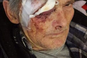 Un bătrân din Lădeşti, bătut crunt de doi minori