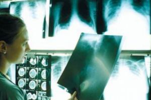 Profesoară, diagnosticată cu TBC. Peste 150 de elevi, testaţi medical pentru tuberculoză