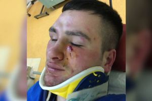 Poliţist desfigurat de un om de afaceri după ce l-a amendat. Agresorul a fost lăsat liber
