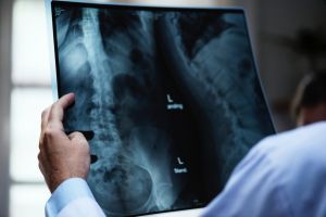 Anotimpul rece, factor de risc pentru osteoporoză