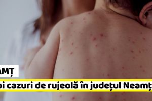 NEAMȚ: 6 noi cazuri de rujeolă în Neamţ