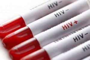 Un american infectat cu HIV a făcut publice numele a peste 14.000 de seropozitivi