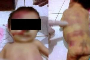 Monştri cu chip de părinţi! Bebeluş de 3 luni se zbate între viaţă şi moarte după ce a fost bătut de tată. Motivul banal care l-a scos din minţi
