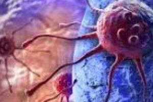 DESCOPERIRE / O companie din Israel a gasit un remediu eficace pentru vindecarea cancerului