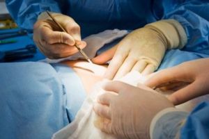 Bihorel: Zece efecte ale demascării falsului medic italian