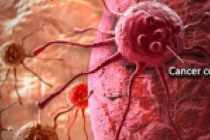 Un aparat modern folosit pentru tratarea cancerului da o speranta bolnavilor din S-E ul tarii
