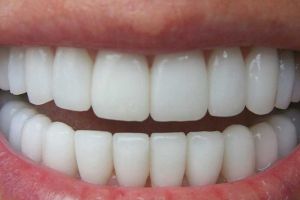 Percheziţii la un fals dentist