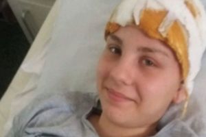Alina, tânăra care a căzut cu tot cu geam dintr-un autobuz, cere daune morale în valoare de un milion de euro