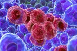 Tratament care poate să vindece complet CANCERUL. Studiu de ultimă oră 