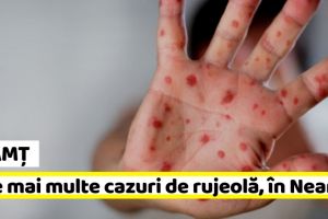 NEAMȚ: Cele mai multe cazuri de rujeolă în ultima săptămână au apărut în judeţul Neamţ