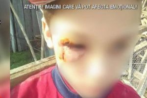 Copilul din Vaslui bătut cu bestialitate de mamă are răni grave la nivelul capului! Ce s-a întâmplat cu femeia după ce iubitul a reclamat-o la poliţie