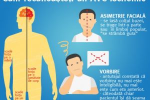 La Spitalul Judetean din Ploiesti va fi implementata procedura care îi poate salva pe pacientii care fac accident vascular cerebral