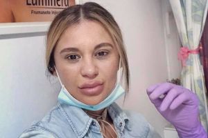 Ai trecut pe la ea? Du-te la un medic adevărat! Cine este falsa esteticiană din Oradea (FOTO)