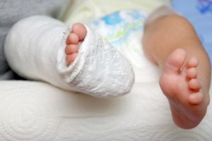 Copil de trei ani cu piciorul rupt, tratat pentru contuzie