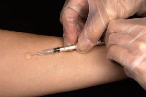 Anchetă epidemiologică la liceul din Predeal. Elevii testaţi medical pentru TBC