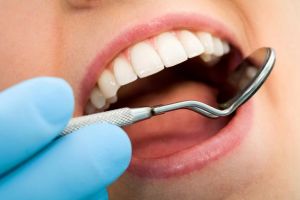 82% dintre români nu au fost la dentist în ultimele 12 luni