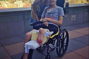 Intervenţie inedită în lumea medicală: picior ataşat invers pentru a forma o nouă rotulă