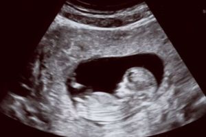 „De ce eu şi soţia mea am decis să îl avortăm pe fiul nostru gay”