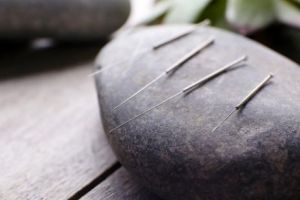 Cel mai bun cabinet de acupunctură din Bucureşti