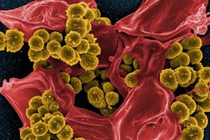 O pacientă va primi despăgubiri de la spitalul unde a contact o infecţie cu stafilococ