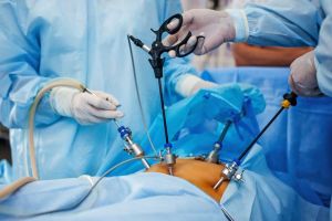 Hernia – Tehnici complexe, minim invazive în chirurgia herniilor