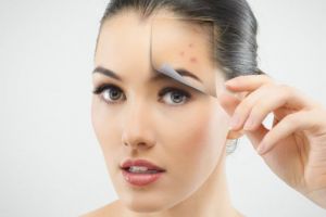 Sfaturi pentru a scăpa de punctele negre