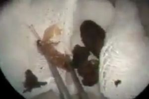 O creatură monstruoasă şi-a făcut cuib în urechea unui om. Momentul ieşirii a devenit viral. Video