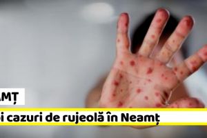 NEAMȚ: 7 noi cazuri de rujeolă în Neamţ