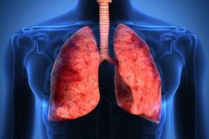 Fibroza pulmonară idiopatică, boală invalidantă şi letală. Rata medie de supravieţuire, 2-3 ani de la diagnosticare