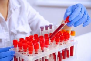 Leucopenia si neutropenia: cum interpretezi rezultatele analizelor