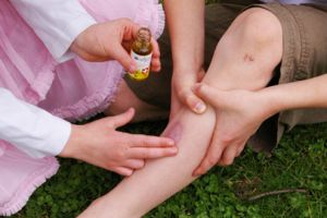 Tăieturile sau juliturile sunt frecvente atât la copii cât şi la adulţi